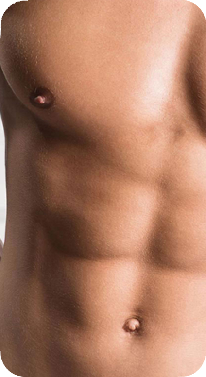 Gynecomastia
